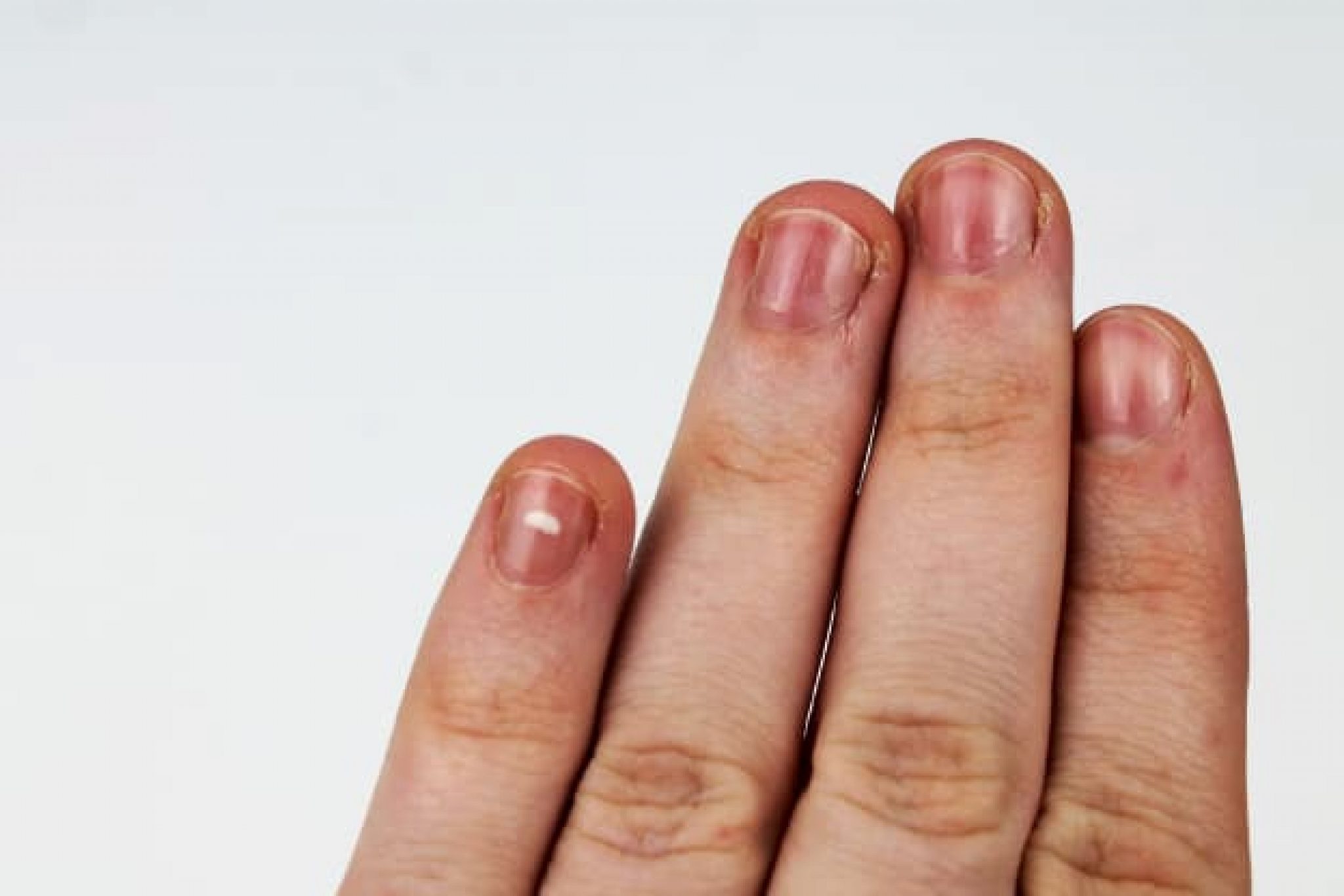 nail care and tips from experts around the world